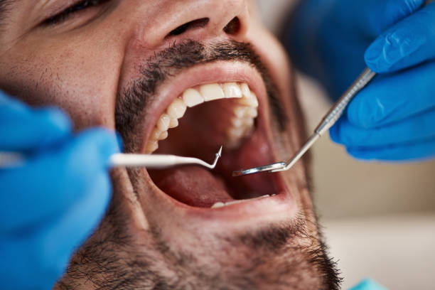 Best Emergency Dental Care for Abscessed Tooth in Lyndonville, VT